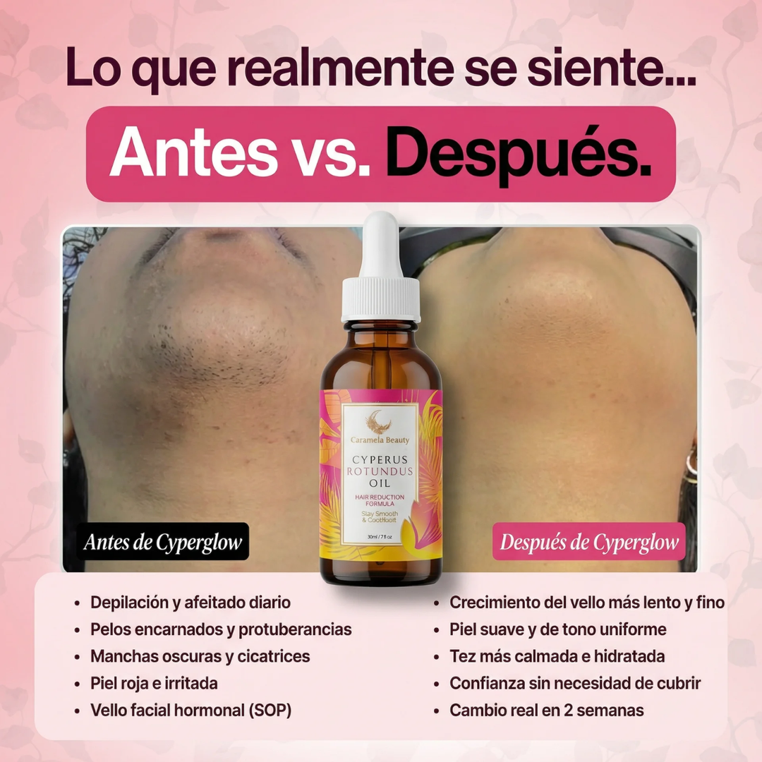 Aceite depilatorio Cyperus BetterAlt™