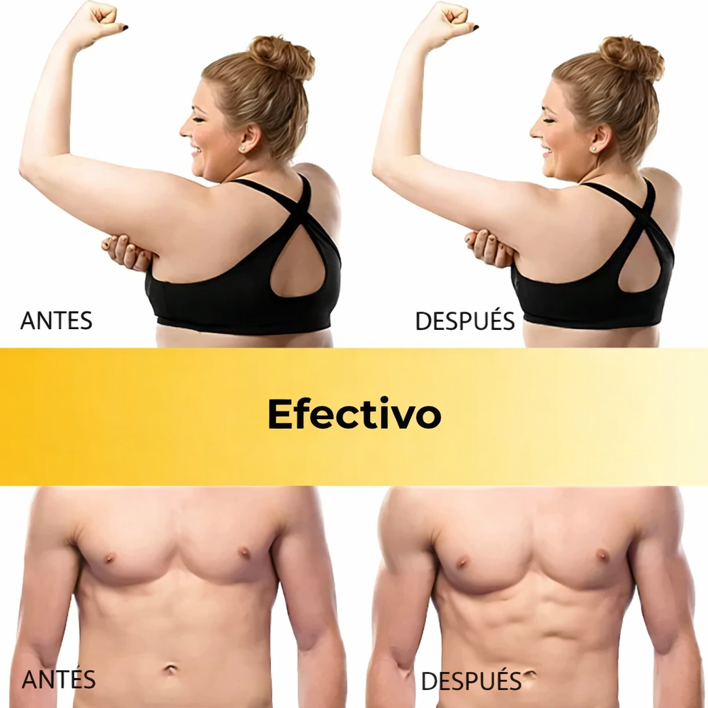 Equipo de estimulacion Abdominal
