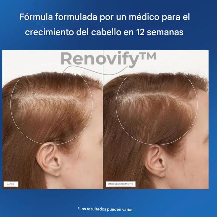 Serum Roll on
