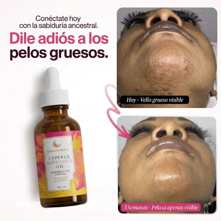 Aceite depilatorio Cyperus BetterAlt™
